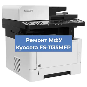 Замена МФУ Kyocera FS-1135MFP в Тюмени
